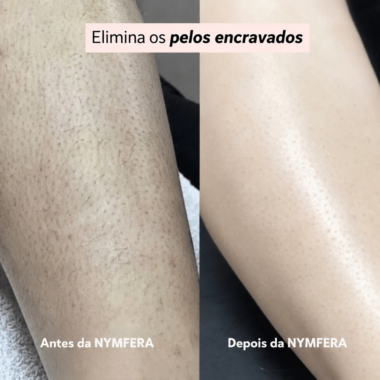 Nymfera Dual-Head PRO • Barbeador Elétrico
