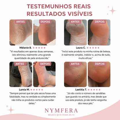 Nymfera – Kit Beleza dos Pés